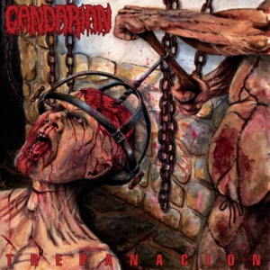 CANDARIAN-trepanacion